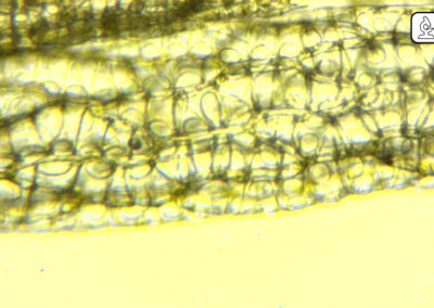 Sphaigne - Microscope